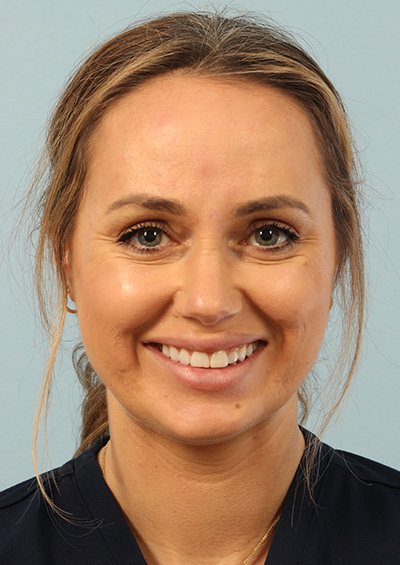 Neurotoxin Before and After 01