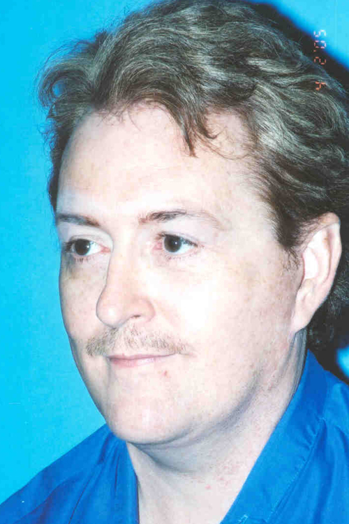 Facelift Before and After 05